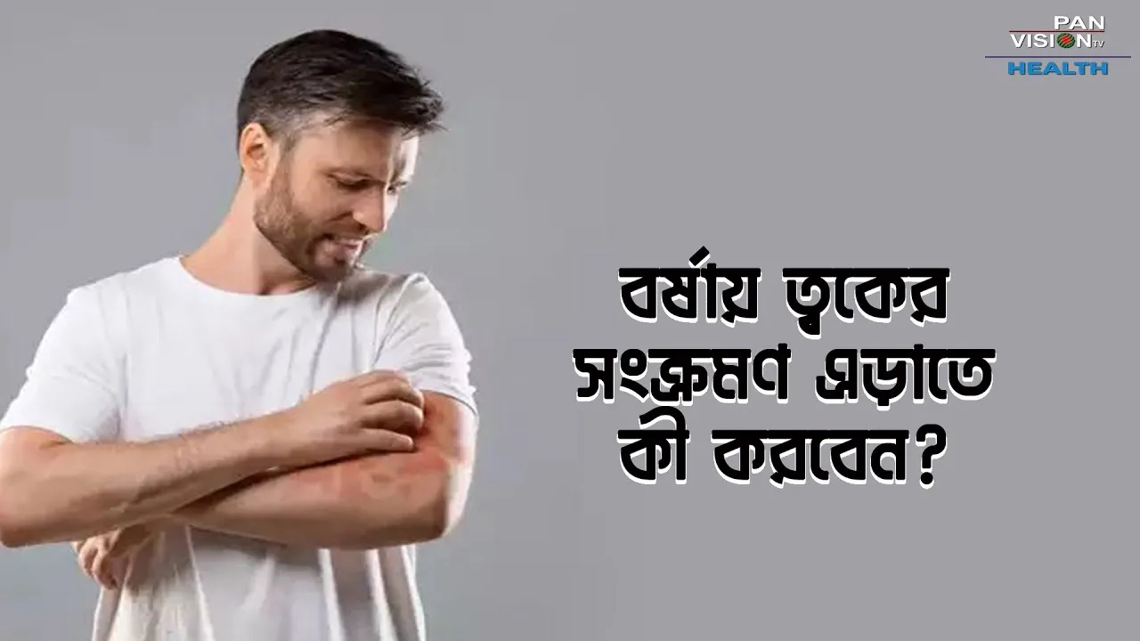 বর্ষায় ত্বকের সংক্রমণ এড়াতে কী করবেন?
